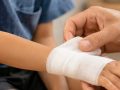 7 Tips Merawat Luka yang Tepat Biar Cepat Sembuh dan Bebas Infeksi