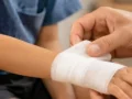 7 Tips Merawat Luka yang Tepat Biar Cepat Sembuh dan Bebas Infeksi
